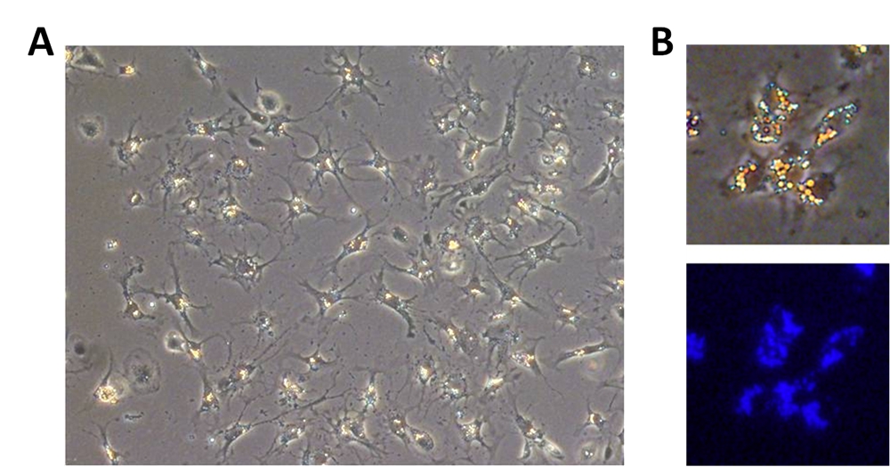 Mouse Hepatic Stellate Cells